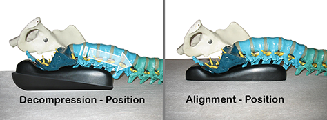 spynamics decompression position